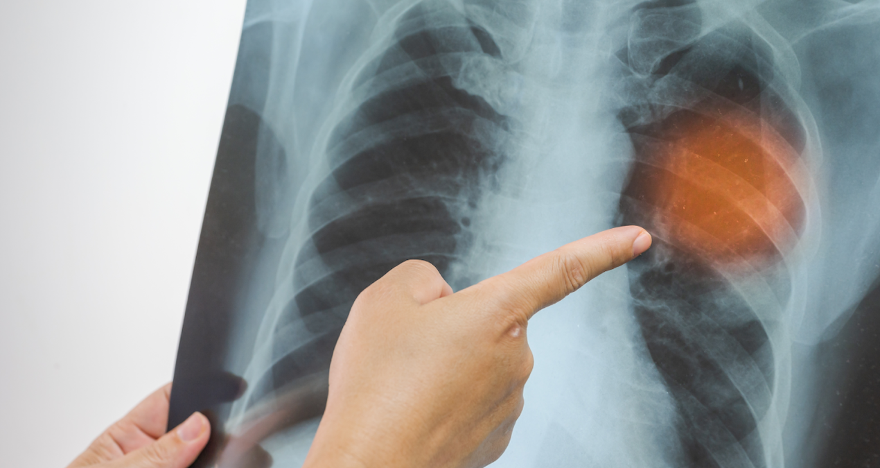 hemen hastaneye gitmenizi gerektiren zaturre belirtileri cogu kisi farkinda bile degil Vhe74OU3.jpg