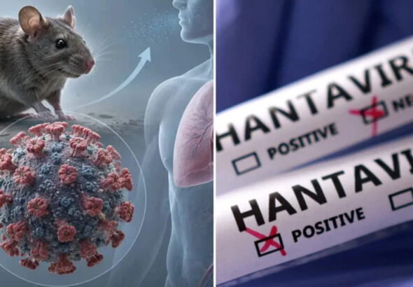 ingiltereden-hantavirus-hamlesi-10-kisi-karantinada-3rnDhsO4